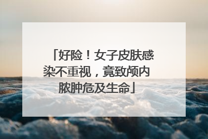 好险！女子皮肤感染不重视，竟致颅内脓肿危及生命